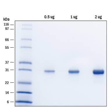 Recombinant Human RNF114 Protein SDS-PAGE
