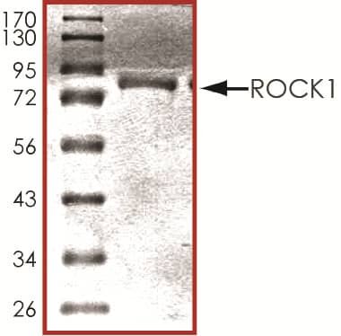 Recombinant Human Active ROCK1 Protein SDS-PAGE