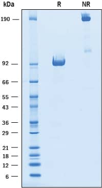 Recombinant Mouse ROR1 Fc Chimera Protein SDS-PAGE