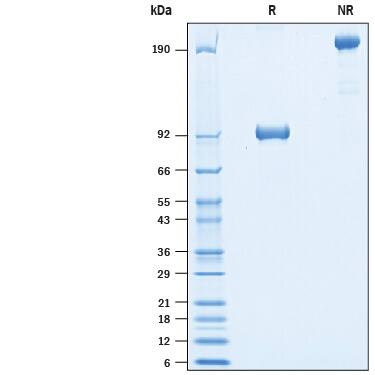 Recombinant Human ROR1 Fc Chimera Avi-tag Protein SDS-PAGE