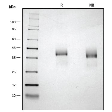 ProDots Recombinant Human R-Spondin 1 Protein SDS-PAGE