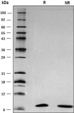 Recombinant Mouse S100A8 Protein SDS-PAGE