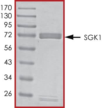 Recombinant Human Active SGK1 (60-end) Protein SDS-PAGE