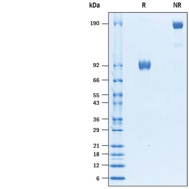 Recombinant Human SIRP alpha/CD172a Fc Avi-tag Protein SDS-PAGE