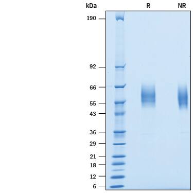 Recombinant Human SIRP alpha/CD172a His Avi-tag Protein SDS-PAGE