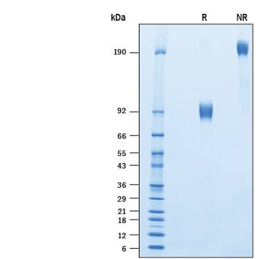 Recombinant Human SIRP alpha/CD172a Fc Chimera Protein SDS-PAGE