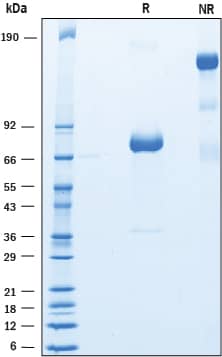 Recombinant Human SIRP gamma/CD172g Fc Chimera Protein SDS-PAGE