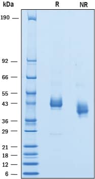 Recombinant Human SIRP gamma/CD172g His-tag Protein SDS-PAGE