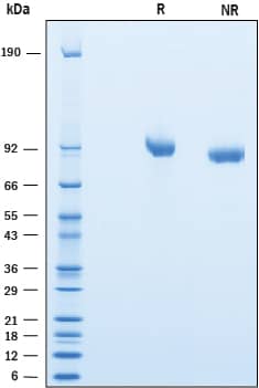 Recombinant Mouse SLITRK2 Protein SDS-PAGE