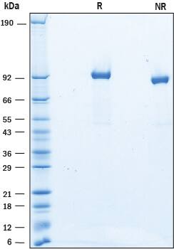 Recombinant Mouse SLITRK4 His-tag Protein SDS-PAGE