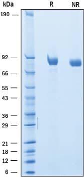 Recombinant Mouse SLITRK6 Protein SDS-PAGE