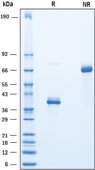 Recombinant Human SLURP2 Fc Chimera Protein SDS-PAGE