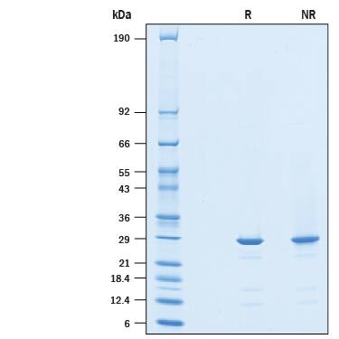 Recombinant Human SPR His-tag Protein SDS-PAGE