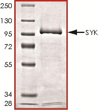 Recombinant Human Active SYK Protein SDS-PAGE