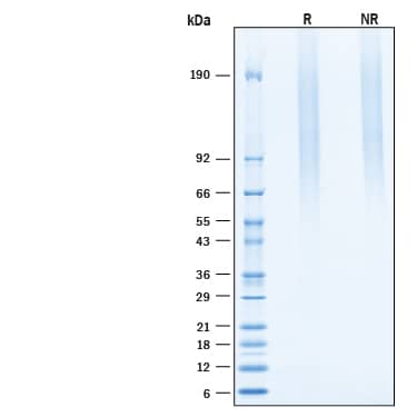Recombinant Mouse Serglycin/SRGN His-tag Protein SDS-PAGE