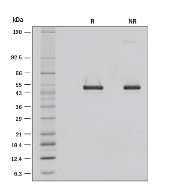 Serpin F1/PEDF-induced Adhesion.