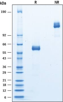 Recombinant Mouse Siglec-15 Fc Chimera Protein SDS-PAGE