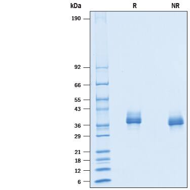 Recombinant Mouse Siglec-15 His-tag Protein SDS-PAGE