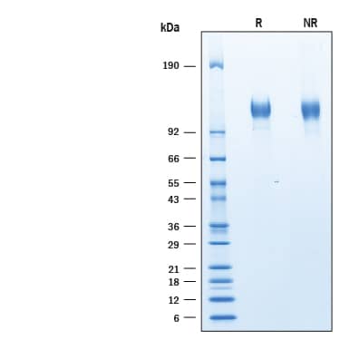 Recombinant Human Siglec-2/CD22 His-tag Protein SDS-PAGE