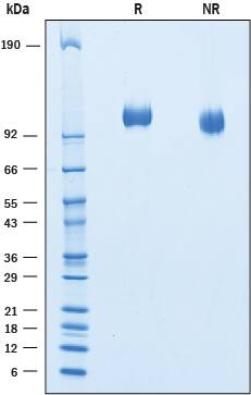 Recombinant Cynomolgus Siglec-2/CD22 His-tag Protein SDS-PAGE
