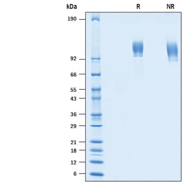 Recombinant Human Siglec-2/CD22 His-tag Avi-tag Protein SDS-PAGE