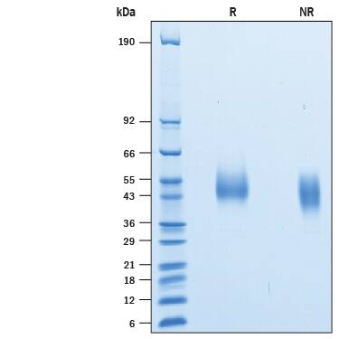 Recombinant Human Siglec-3/CD33 His-Tag Avi-Tag Protein SDS-PAGE