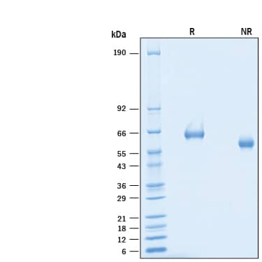 Recombinant Mouse Siglec-F His-tag Protein SDS-PAGE