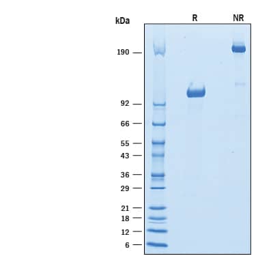 Recombinant Mouse Siglec-G Fc Chimera Protein SDS-PAGE