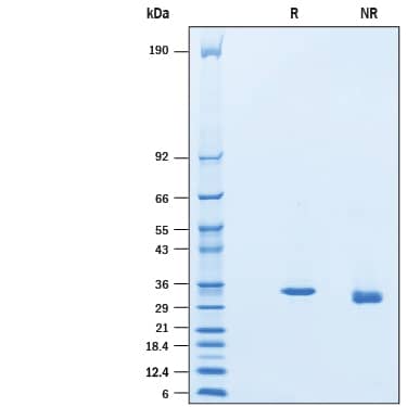 Recombinant Human Sirtuin 5/SIRT5 His-tag Protein SDS-PAGE