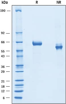 Recombinant Mouse Slit1 (aa 1126-1531) Protein SDS-PAGE