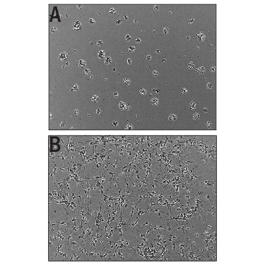 Recombinant Human Slit2 (aa1122-1529) Protein Bioactivity