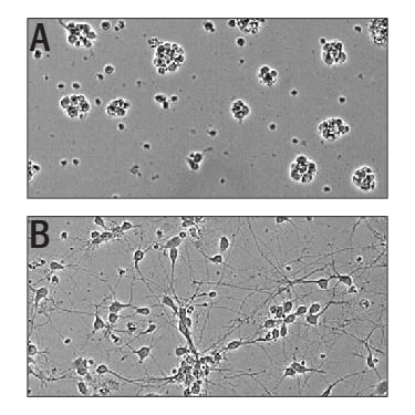 Recombinant Human Slit3 (aa 1120-1523) Protein Bioactivity