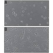 Recombinant Human Slit3 (aa 34-1116) Protein Bioactivity