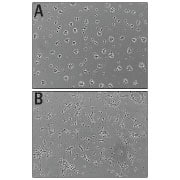 Recombinant Mouse Slit3 (aa 1117-1523) Protein Bioactivity