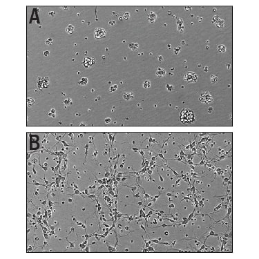 Recombinant Mouse Slit3 (aa 34-1116) Protein Bioactivity