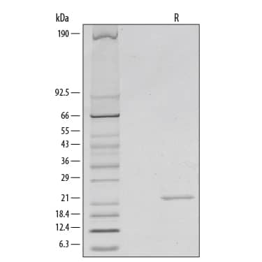 Recombinant Mouse Sonic Hedgehog/Shh, N-Terminus Protein SDS-PAGE