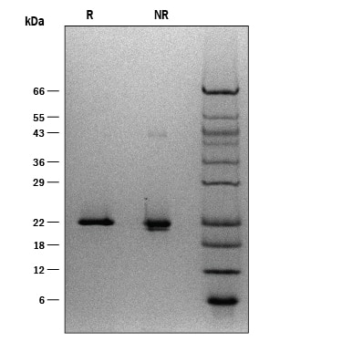 ProDots Recombinant Human Sonic Hedgehog/Shh (C24II) Protein SDS-PAGE