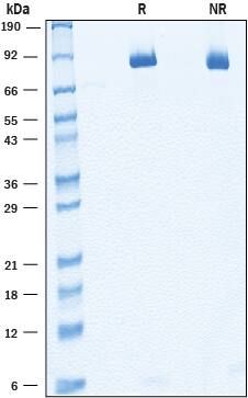 Recombinant Human SorLA (aa 82-753) Protein SDS-PAGE