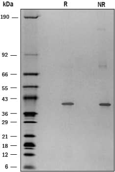 Recombinant Mouse TDO2 His-tag Protein SDS-PAGE