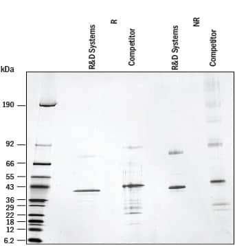 Recombinant Human TDO2 Protein SDS-PAGE