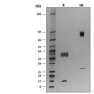 Recombinant Human Latent TGF-beta 1 Protein SDS-PAGE