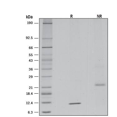 TGF-beta 2 Suppresses IL-4-induced Proliferation.