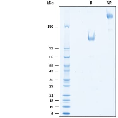 Recombinant Human TIM-1/KIM-1/HAVCR Fc Avi-tag Protein SDS-PAGE