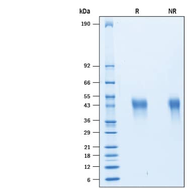 Recombinant Human TIM-3 His-tag Protein SDS-PAGE