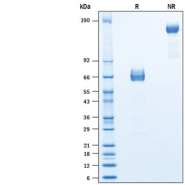 Recombinant Rat TIM-3 Fc Chimera Protein SDS-PAGE