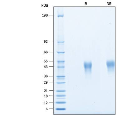 Recombinant Human TIM-3 His-tag Avi-tag Protein SDS-PAGE