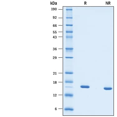 Recombinant Human TNF-alpha (HEK293-expressed) Protein SDS-PAGE