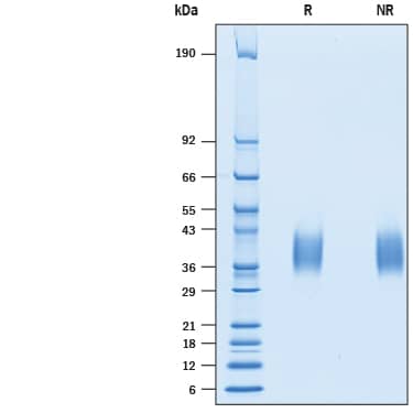 Recombinant Human TREM-1 His-tag Protein SDS-PAGE