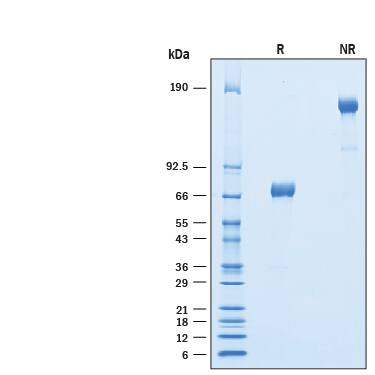 Recombinant Mouse TREML4/TLT-4 Fc Chimera Protein SDS-PAGE
