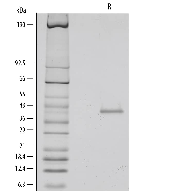 Recombinant Human TSG-6 Protein SDS-PAGE